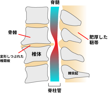 首が痛い症状でお悩みの方へ